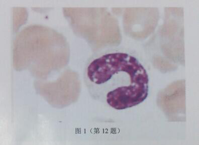 如图1所示，血涂片所见白细胞为()。