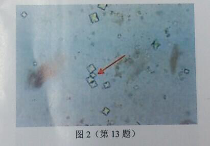 尿沉渣镜检图片如图2所示，箭头所示成分是()。