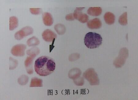 外周血涂片镜检如图3所示，箭头所示细胞是()。