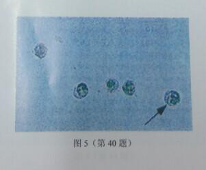 如图5所示，尿液沉渣涂片箭头所指细胞为()。