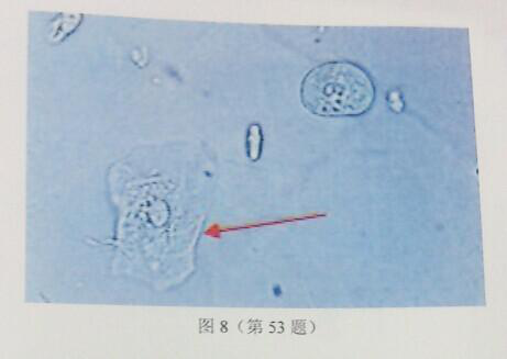 尿沉渣镜检图片如图8所示，箭头所示细胞是()。