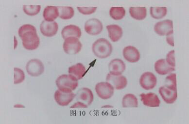 外周血涂片镜检，如图10所示，箭头所示细胞是()。