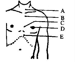 为成人进行心肺复苏（CPR)，心脏按压的按压点应位于图示的A.AB.BC.CD.DE.E为成人进行心