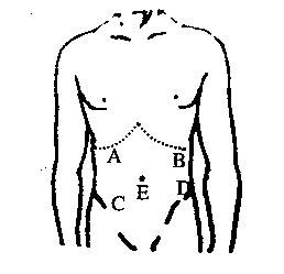 最常见压痛点在a.ab.bc.cd.de.e对急性胆囊炎患者行腹部触诊，最常见压痛点在