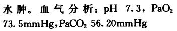 【案例】患者男性，64岁。15年来反复出现咳嗽、咳白色泡沫痰，当受凉或劳累后症状加重，咯黄痰，每年发