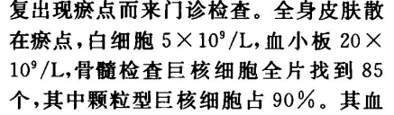 患者，女性，23岁。因2年来全身皮肤反点， 小板减少的发病机制主要是A.血小板生成减少B.血小板成熟