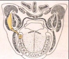 智齿冠周炎不能直接扩散到  （)A、颞间隙B、颊间隙C、咬肌间隙D、翼颌间隙E、咽旁间隙智齿冠周炎不