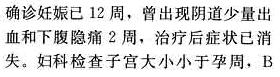 124－－125第124题：124--125第124题：请帮忙给出正确答案和分析，谢谢！