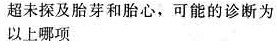 124－－125第124题：124--125第124题：请帮忙给出正确答案和分析，谢谢！