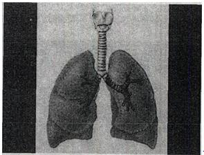 对支气管肺段的描述如图，正确的是A.由肺间质构成B.是二级支气管所属的肺组织C对支气管肺段的描述如图