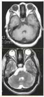 关于MRI，描述正确的是（）