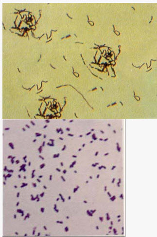 某细菌在血琼脂平板上生长时菌落细小、凸起，有光泽的革兰阳性杆菌，菌体长短不一，触酶阴性，分解葡萄糖、