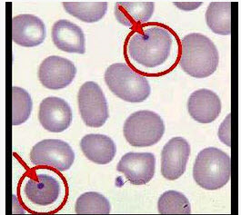 图中所示的红细胞结构为（）