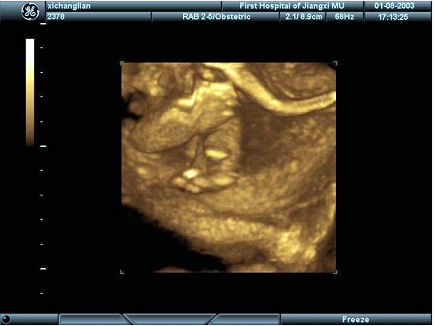 女性，25岁，停经35周。产前超声检查，图像显示的是胎儿的（）。