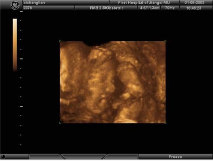 女性，25岁，停经35周。产前超声检查，图像显示的是胎儿的（）。