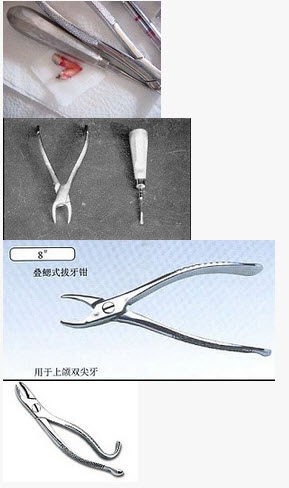 牙钳的使用下述何种方法是错误的（）