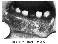 患者，女，56岁，职员。	主诉：左上前牙缺损多年，要求修复。	现病史：多年前左上前牙发黑，且出现冷热