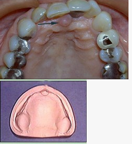 无牙颌患者的口内特征为（）