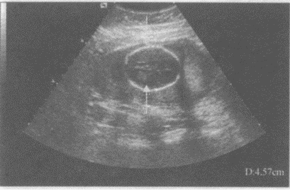 请指出下图箭头所指的是胎儿哪一部位（）。