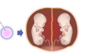 如图所示，此单卵双胎的分裂发生在______。	