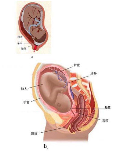 如图所示阴道分娩时图____即_____胎膜破口离胎盘近，产后检查胎盘胎膜，若胎膜破口距胎盘边缘__