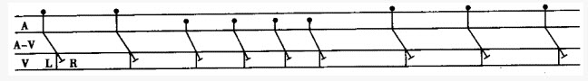 梯形图中第3至第6个心搏用A行中的黑圆点表示，心率为105次／分，说明存在（）。