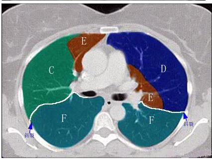 结合肺段模式图，右肺下叶的组成是（）