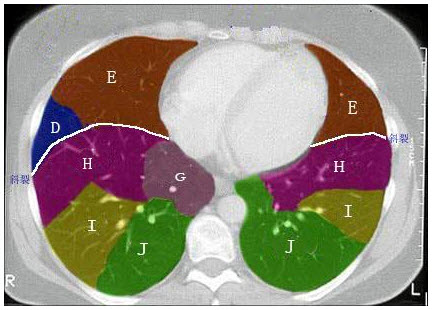 结合肺段模式图，右肺下叶的组成是（）