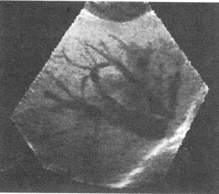 下图是采用了哪项超声新技术显示肝脏及其内部血管（）。