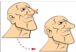 如图所示：要把左图中鼻子的形状变成右图中圆滑的效果，下列描述不正确的是（）。	A. 使用Conver