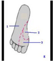 如图E中1所示皮肤感觉区的脊髓中枢()如图E中2所示皮肤感觉区脊髓中枢()如图E中3所示皮肤感觉区脊