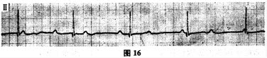 心电图诊断（）。