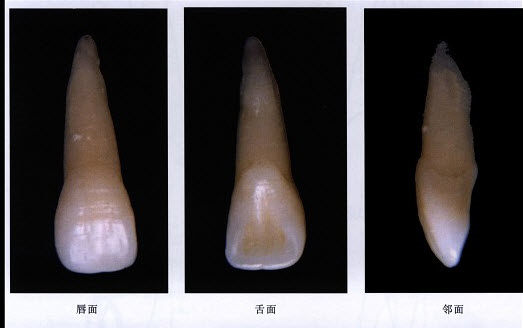 	下列哪项不是前牙的解剖结构（）。A. 唇面B. 舌面或腭面C. 近中面D. 远中面E. 面