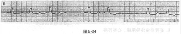 患者男性，47岁，胸闷症状。心电图如图5-24所示，应诊断为（）。