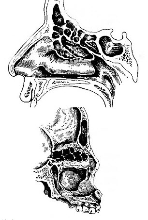 如图，前组鼻窦包括_____、_____、______。其窦口在中鼻道，后组鼻窦包括____和___