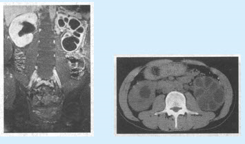 MRI、CT以下疾病中与该病关系最大的是（）