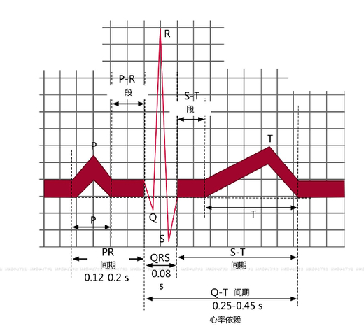  如上图所示，在正常心电图上，从QRS波群开始心动周期将进入哪一期？