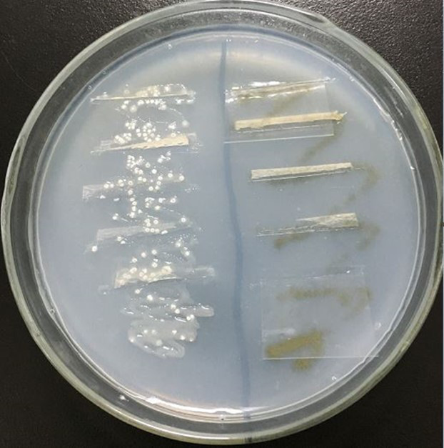 细菌培养结果图片