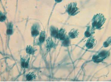 在显微镜下观察到如下结果，这是（）菌的标准切片。 