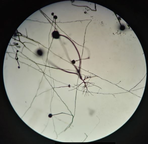 下图是一位同学的霉菌插片培养的显微观察结果，该霉菌最显著的形态特征有哪些？ 