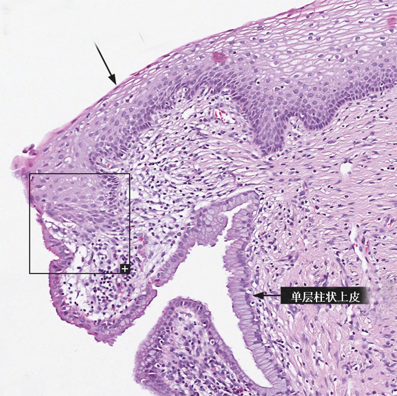 下图为子宫颈与阴道相交界的部位图中已经标记出了一