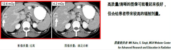 图中A、B是CT图像，A图像清晰，但是患者受到的照射剂量高，B图像质量不高，但是箭头指示处能够看到病
