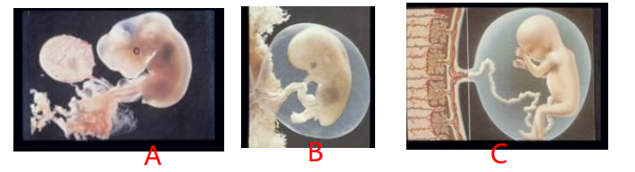不同发育阶段的胎儿对辐射的敏感性不同，下列三幅图中胎儿敏感性描述正确的是()