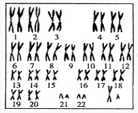 下图为某一人体细胞内的染色体图谱，下列叙述不正确的是（）