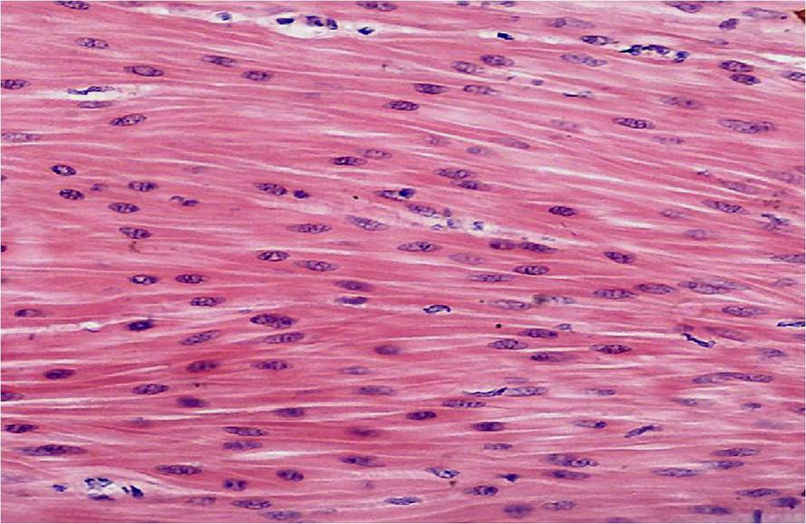 [图]a,胶原纤维b,平滑肌c,心._简答题试题答案