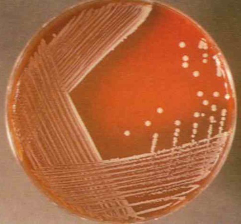 链球菌菌落图片