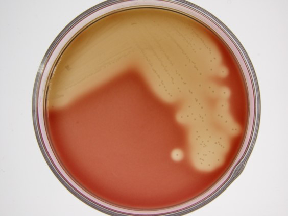 乙型溶血性链球菌绘图图片