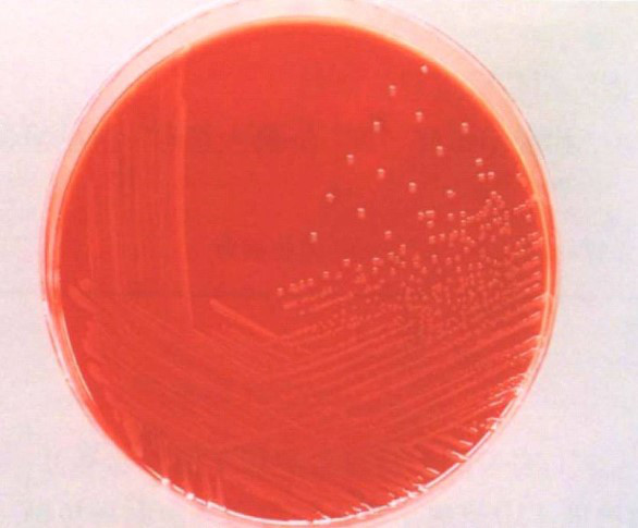 溶血性链球菌镜检图片图片