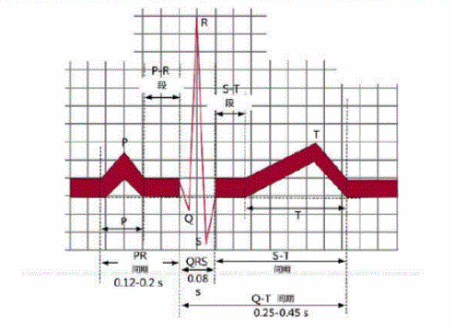 如图所示，在正常心电图上，从QRS波群开始心动周期将进入哪一期？
