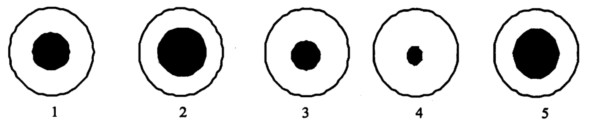 药物对瞳孔影响如下所示：1为正常瞳孔，2、3、4、5组药物分别为 A．阿托品、吗啡、有机磷酸酯类、新